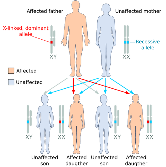 X-linked dominant, affected father